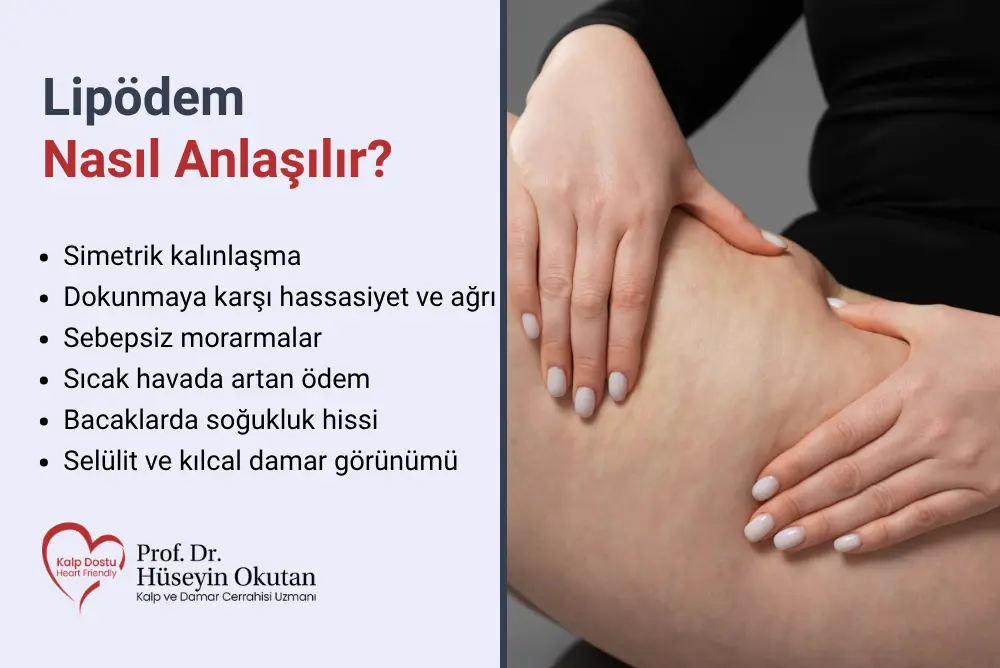 Lipödem Nasıl Anlaşılır? Lipödem Nasıl Anlaşılır? | Prof. Dr. Hüseyin Okutan