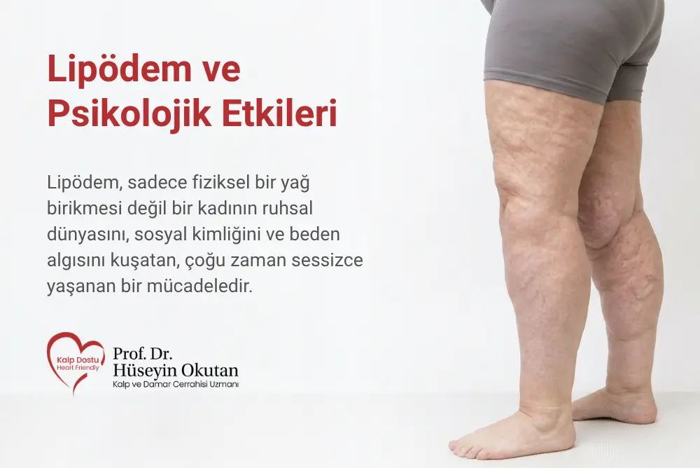 Lipödem ve Psikolojik Etkileri