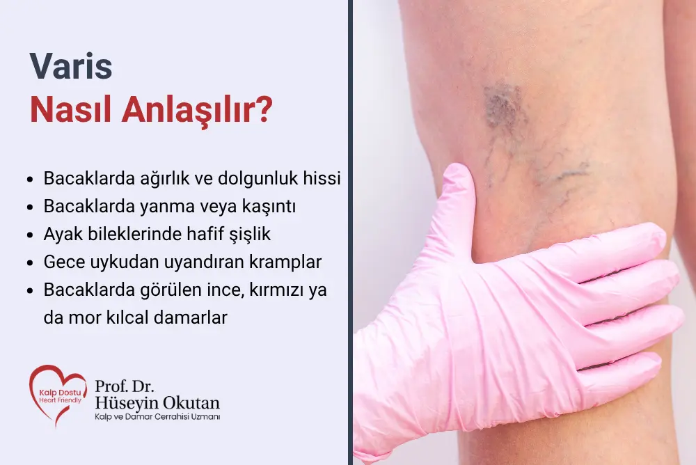 Varis Nasıl Anlaşılır? Teşhisi Nasıl Konur? | Prof. Dr. Hüseyin Okutan