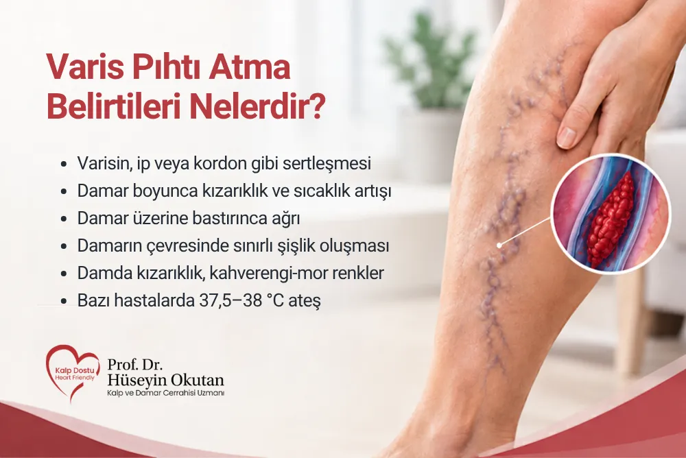 Varis pıhtı atma belirtileri nelerdir? | Prof. Dr. Hüseyin Okutan