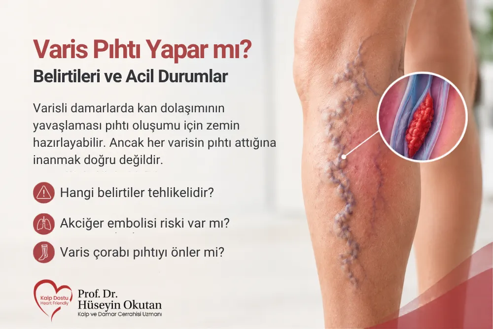 Varis Pıhtı Yapar mı? Belirtileri ve Acil Durumlar | Prof. Dr. Hüseyin Okutan