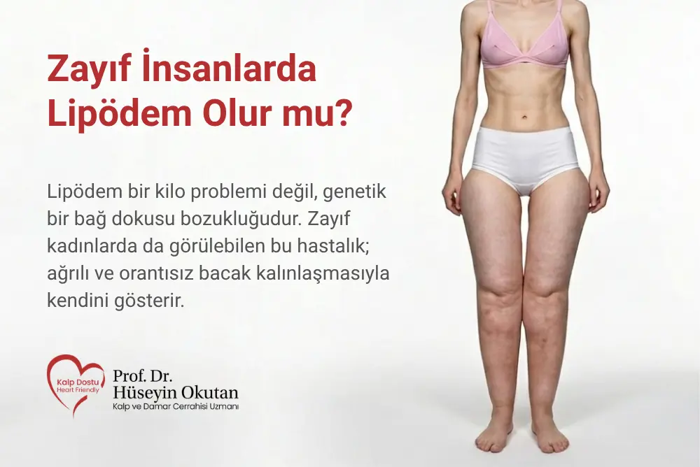 Zayıf İnsanlarda Lipödem Olur mu? Zayıflarda Lipödem Belirtileri, Teşhisi ve Tedavi Yöntemleri